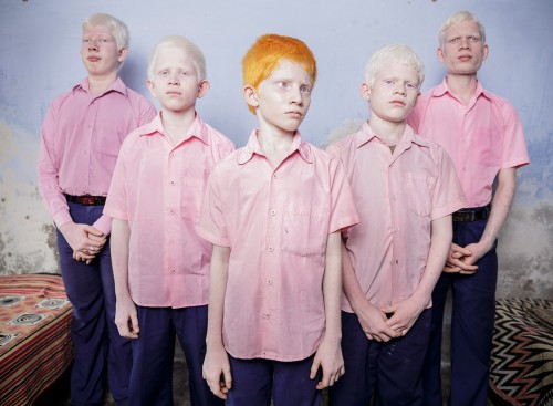 Albinos Ciegos en el Oste de Bengal