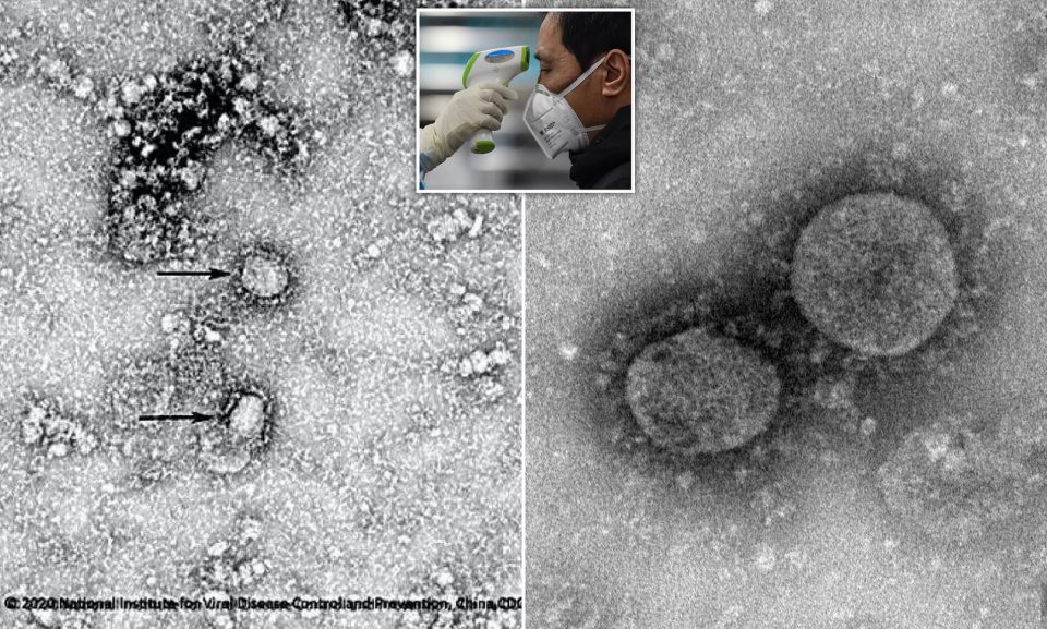 COVID 19 en Microscopio